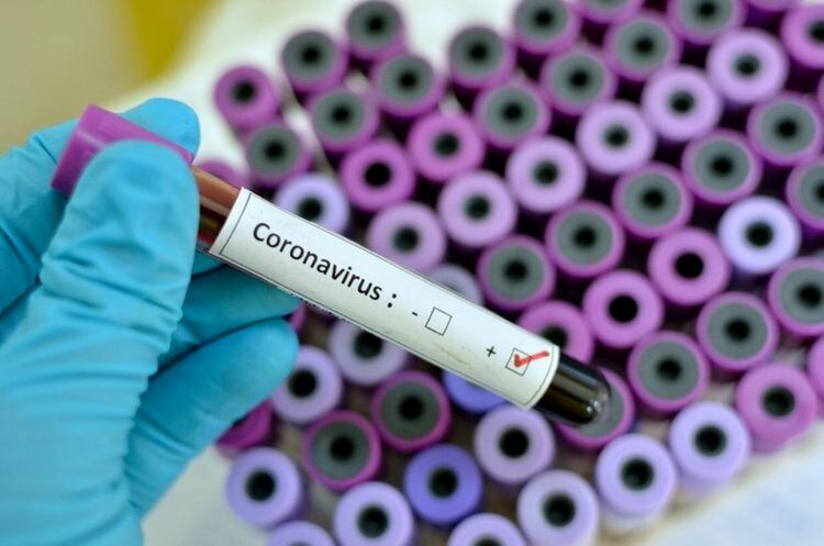 113 са новите случаи на COVID-19 в област Пловдив 